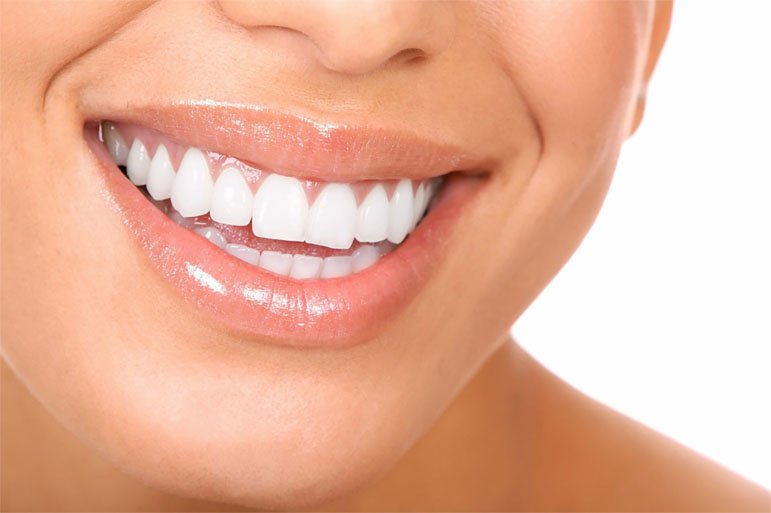 Laser Gingivoplasty